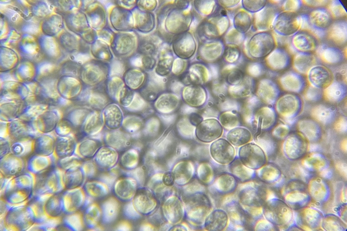 Crowded round and oval baking yeast cells photographed through a light microscope with a 40X objective