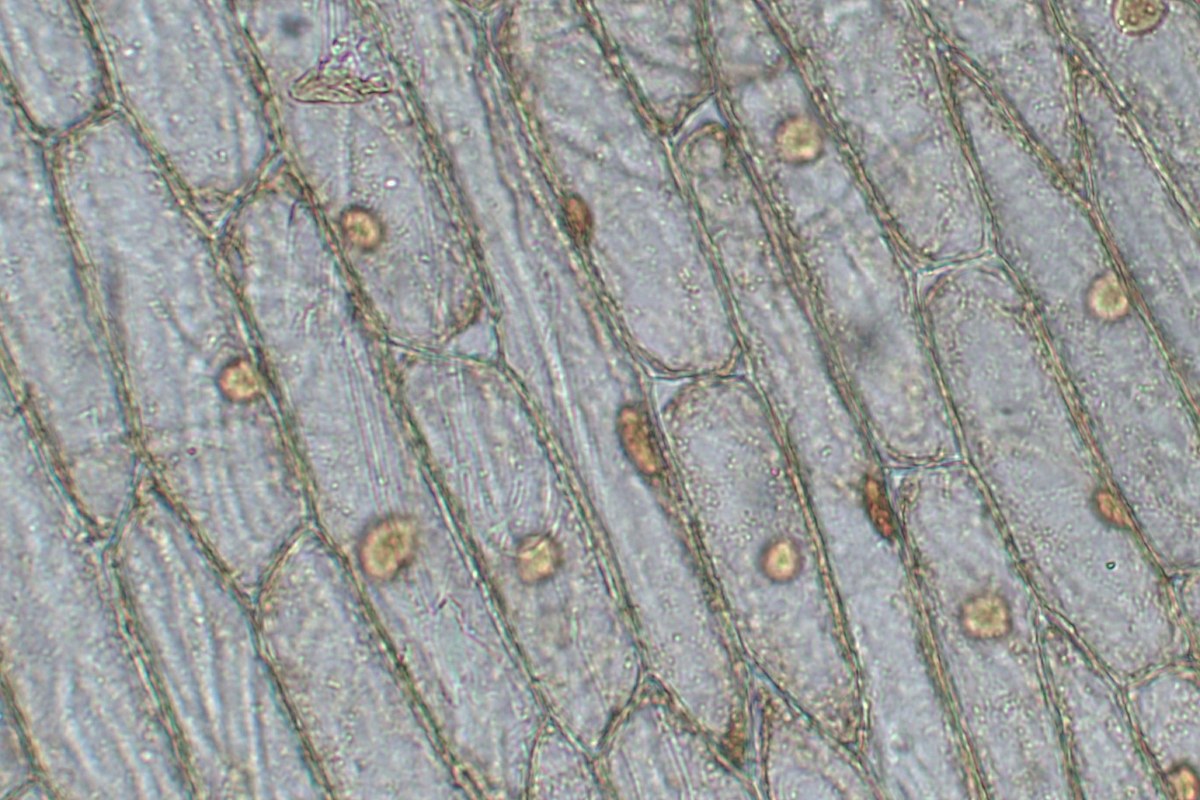 Living onion epidermis cells viewed through a light microscope at 300 times magnification