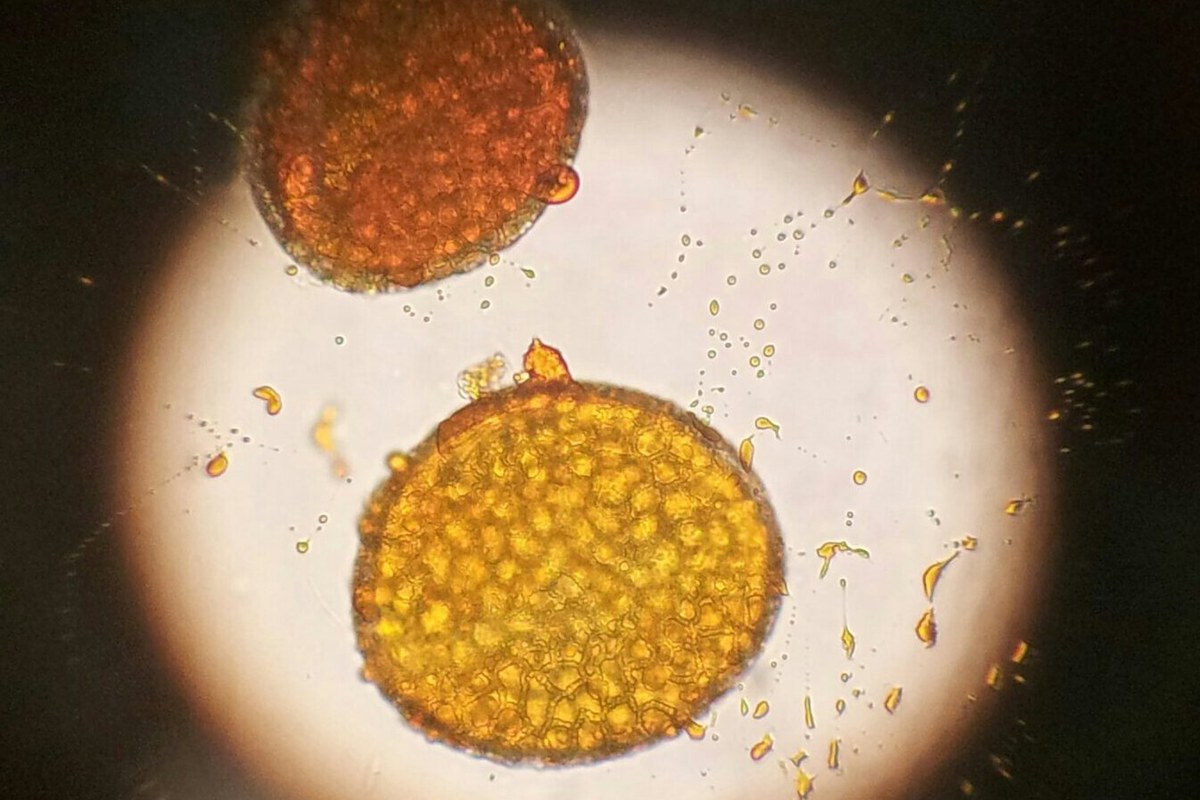 Lily pollen grains in water under a light microscope, with a golden grain and its textured wall in focus