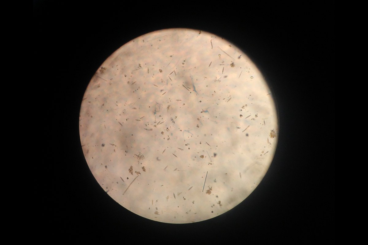 Circular microscope field showing pond water with diatoms, algae, and suspended debris