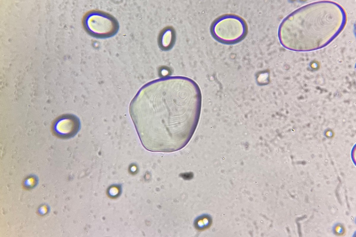 Potato starch granules of different sizes under a light microscope, with curved internal rings visible in two large granules